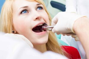 Wisdom Teeth Recovery Timeline: Day-by-Day Healing Guide