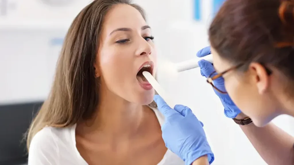 CID10J03 (ICD-10 J03): Acute Tonsillitis Coding & Treatment