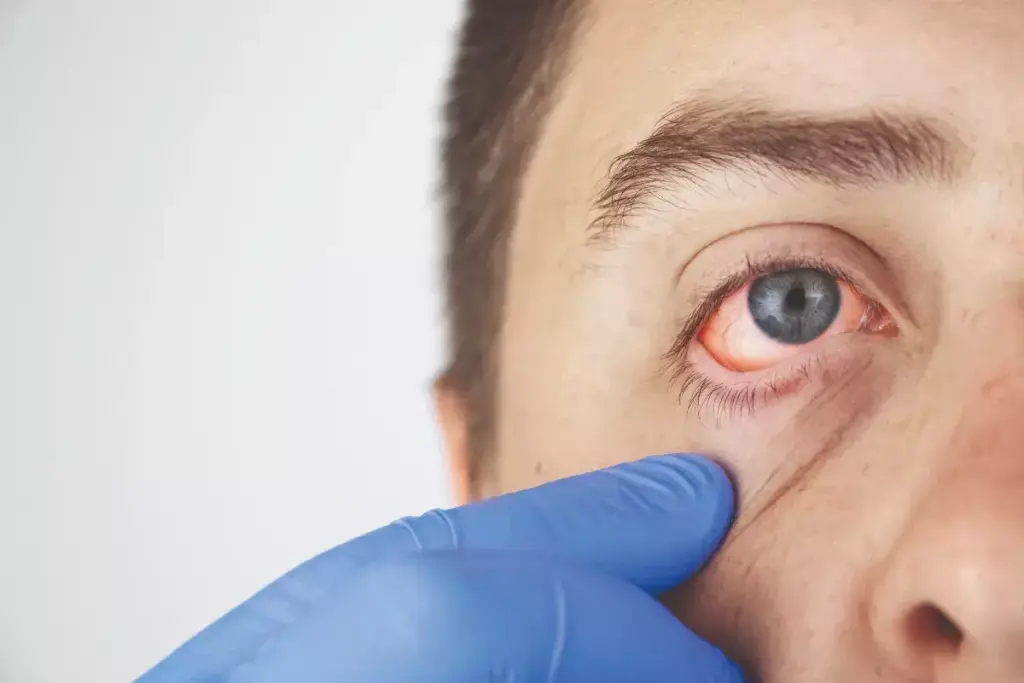 Ficulititotemporal: Meaning, Symptoms & Applications Guide