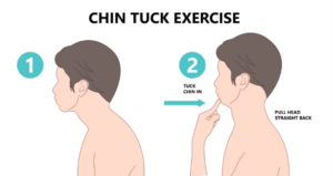 Chin Tuck Exercise: Perfect Form for Neck Pain Relief