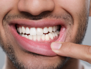 Bump in Mouth: Causes, Relief & When to See a Doctor